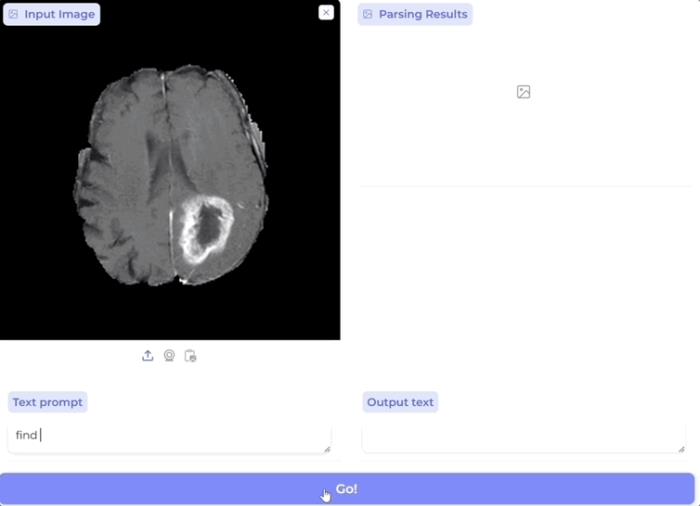 AI一键解析九大生物医学成像模式,用户只需文字prompt交互,微软UW等新研究登Nature Methods